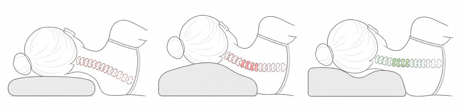 Side-view diagram showing a flat pillow, a central-ridge contour pillow, and a cervical-valley butterfly pillow with C5-C7 alignment overlay